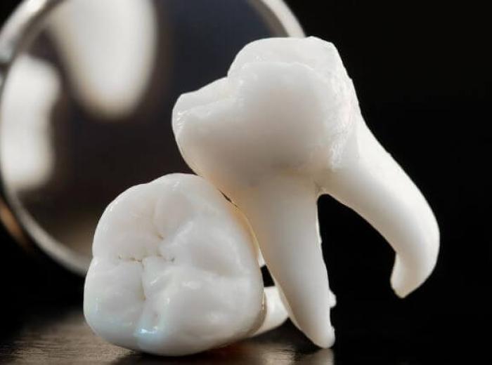 Bleeding Gums? Here's What a Deep Cleaning Actually Is